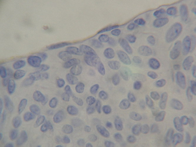 Fig. 12 - CD31